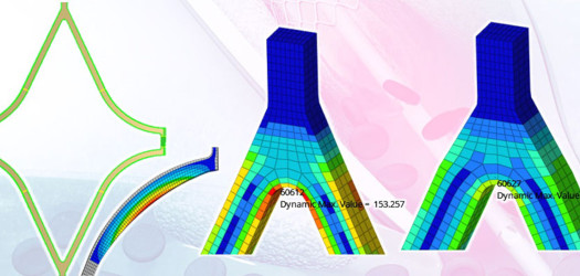 Altair HyperStudy medikal ekipman optimizasyonu